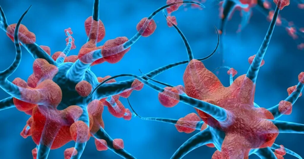 Informatii-despre-imbatranirea-nervilor-neuropatie-si-diferite-remedii-naturale.jpg